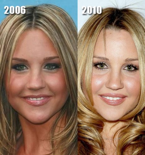 Has Amanda Bynes had cosmetic surgery? (image hosted by mydochub.com)