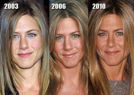 Jennifer Aniston Plastic Surgery - Before & After Pictures 2016