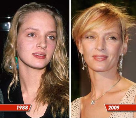 Nose Plastic Surgery on Uma Thurman Plastic Surgery Nose Job  Family Funeral   Cannes Juror